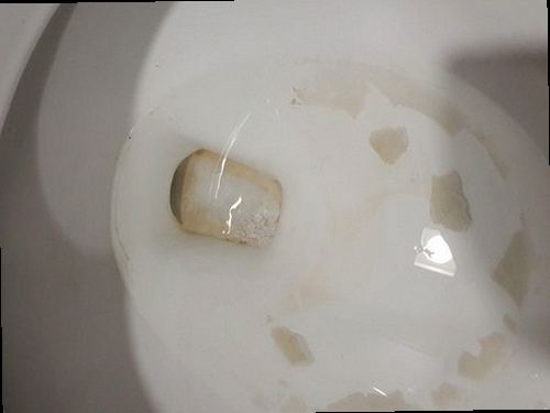 종로구 하수구막힘 배수 속도가 느려지고 물이 고인 처치 전 싱크대 주변
